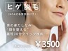 《人気No.1》“奈良でヒゲ脱毛”といえばNOA★学割あり￥3500(平日￥2500)