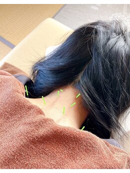 つむぎ養生堂マッサージ処の写真/首肩の辛さに東洋医学的アプローチ。慢性痛・自律神経も整える鍼灸院