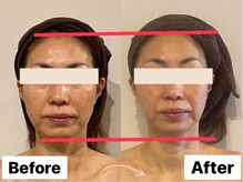 イオム ビューティワーク(IOM BEAUTY WORK)