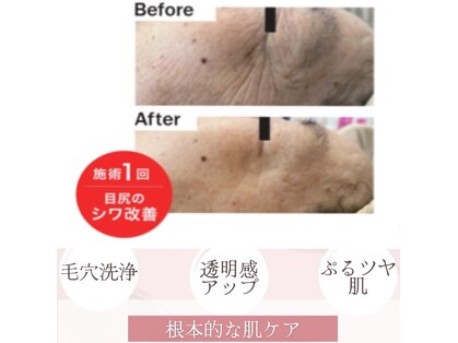 ルミナ(LUMINA)の写真