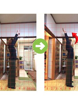 サプライズ整体院/30代ママさんの肩こり初回結果