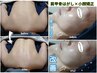 人気No2【結果重視◎】神業手技★小顔矯正×肩甲骨×ヘッドスパ75分13200→