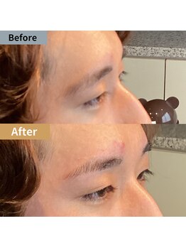 眉毛ハウス 吉祥寺店(眉毛HOUSE)/お客様の施術例(吉祥寺/東京)