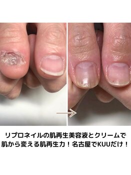 肌生まれ変わりに特化したオイル