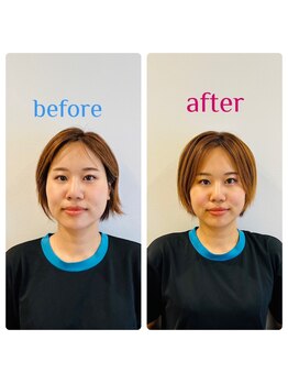 トゥービー(TWO-B)/【小顔矯正】スッキリなお顔へ