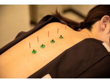 ムーン(Moon)/お灸