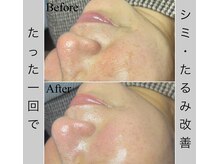 ブラックボックス(BLACK BOX)/50代女性のお客様