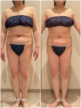 クラヴェル(Clavel)/50代後半セルゼロ2症例