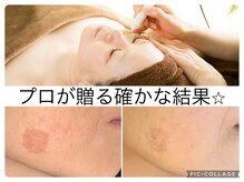 エクシア(ECXIA)