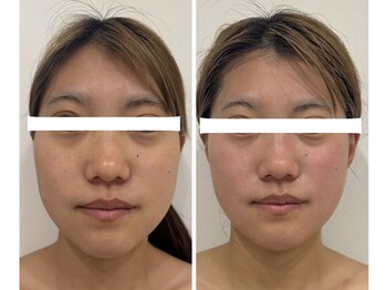 ありひ/オーダーメイドエステ効果！！