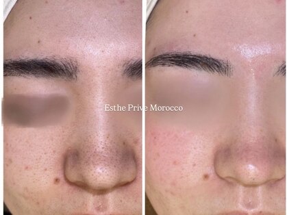 エステプリヴェモロッコ(ESTHE PRIVE MOROCCO)の写真