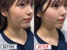 【人気No.2】地域最安値!ドライヘッドスパ+小顔矯正コルギ70分¥6,980☆男性可
