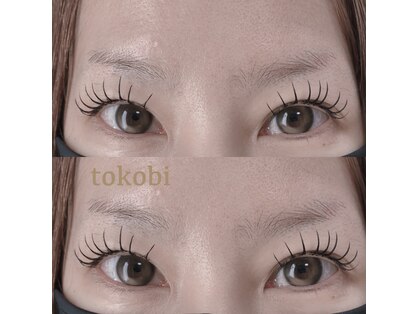 トコビ(tokobi)の写真