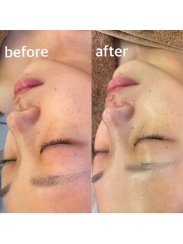 メナードフェイシャルサロン 中萩/