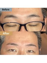 眉毛ハウス 吉祥寺店(眉毛HOUSE)/お客様の施術例(吉祥寺/東京)