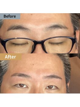 眉毛ハウス 吉祥寺店(眉毛HOUSE)/お客様の施術例(吉祥寺/東京)