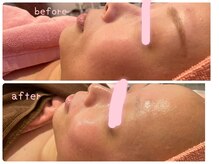 ヒメミ(Himemi)/艶肌Ｗａｘ