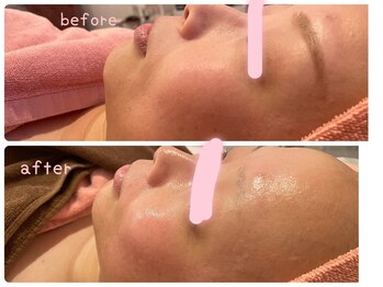 ヒメミ(Himemi)/艶肌Wax