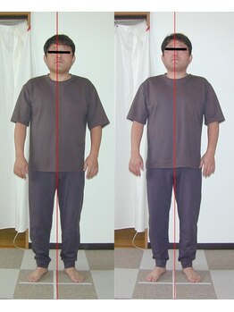 ピュアリー整療院/施術前後（正面）