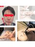 【たるみ改善・小顔リフトアップ】ほうれい線、二重あごが気になる方