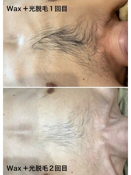 ルシェリ(Lecheri)/2回目の効果♪