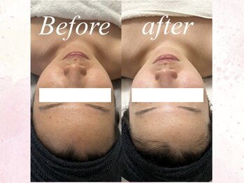 カラン(Calin)/ダイヤモンドピーリング♪