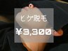人気No.1★《メンズ脱毛》ヒゲ 通常¥8,800→【¥3,300 】※2回目も同価格