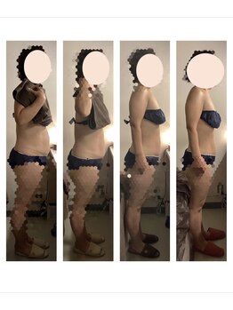 アクア エステティコ 亀有(ACQUA estetico)/痩身　腹部