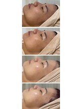 エムイーボーテ(me.Beaute)/【セルマン】継続は力なり！