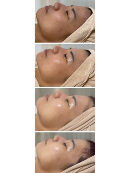 エムイーボーテ(me.Beaute)/【セルマン】継続は力なり！