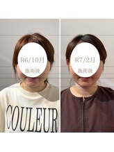 トイ鍼灸接骨院(TOY鍼灸接骨院)/●美容鍼灸