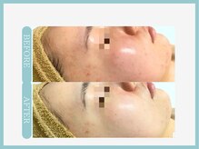 アコガレコガオ 青森店/