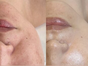 サロン エデンプラス(salon eden PLUS)/細胞活性でお肌の土台力アップ