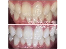 ホワイトニングルーム 横浜店(Whitening Room)/ホワイトニング/横浜