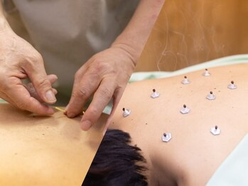 まきせ鍼灸整体院の写真/《全身整体×鍼施術で根本からの改善!》肩こり・首コリ・頭痛…その悩み、もう我慢しなくて大丈夫です♪