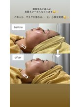 クレール 小山店(CLAIR)/【韓国定番3STEP】