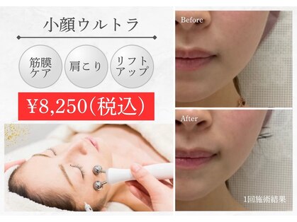 アデージョ アデオス(Ade-jyo.Adeosu)の写真