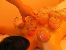 百草堂 栄店/カッピング♪