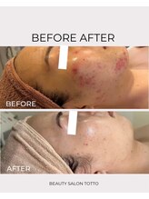 トット 恵比寿(totto)/ケア症例