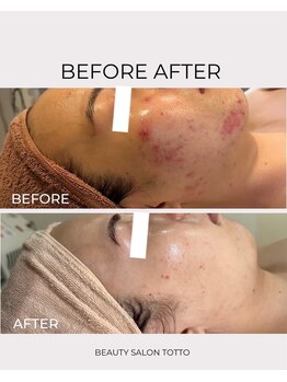 トット 恵比寿(totto)/ケア症例