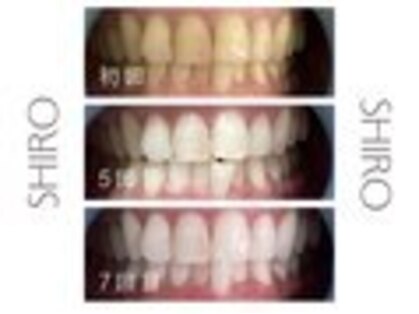 シロ 戸塚店(SHIRO)の写真