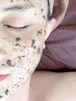 マハロ(mahalo)の写真/人気のハーブピーリングで素肌を美しく！天然素材使用で剥離なし◎思わず見惚れる素肌を目指しましょう♪