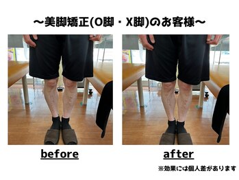 トータルビューティーみつとも/O脚矯正/美脚矯正