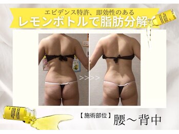 エステティックサロン フェアリー(ESTHETIC SALON FAIRLY)/小顔＊レモンボトル導入店