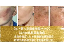 プラセル(PLACER)の雰囲気（オーナー愛用スキンケアSango）