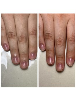 リヒネイル(Rihi.nail)/自爪育成