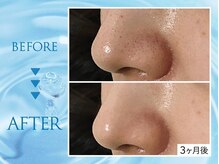 クリアラボ 池袋2nd(Clear Lab)/韓国肌管理&毛穴洗浄専門店