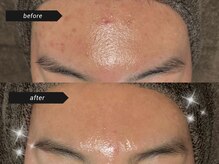 ビビ(Vivi)の雰囲気（本気の肌質改善をするならハーブピーリング♪）