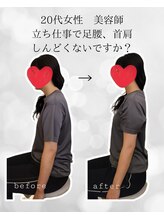 シナジェ 並木通り店(Synergye)/ストレートネックに◎