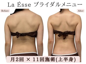 ラエッセ(La Esse)/天使のはね爆誕